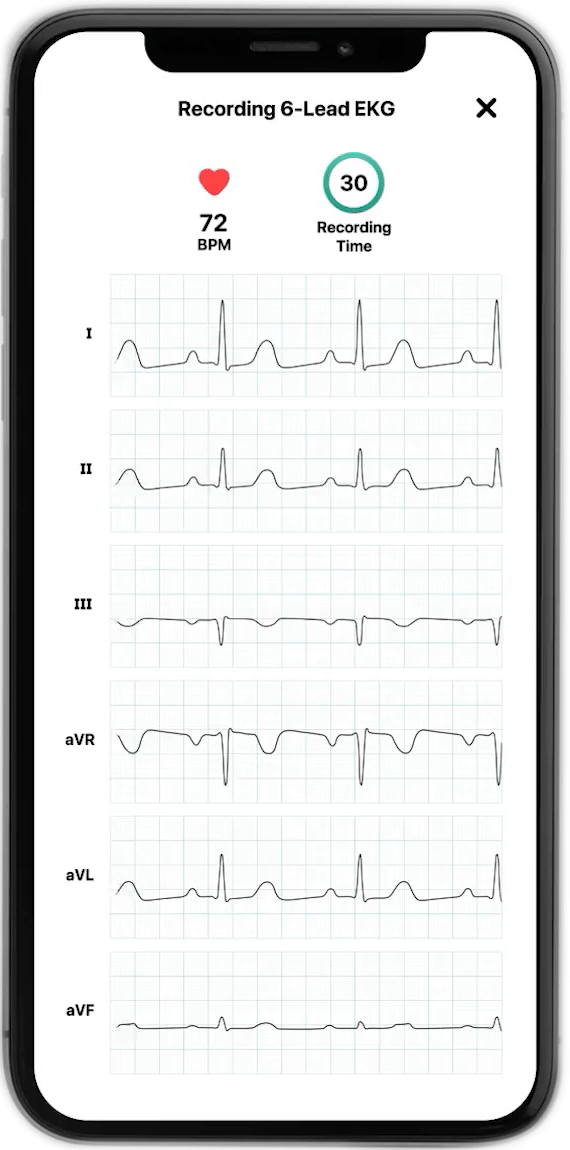 gif2 Omron Healthcare